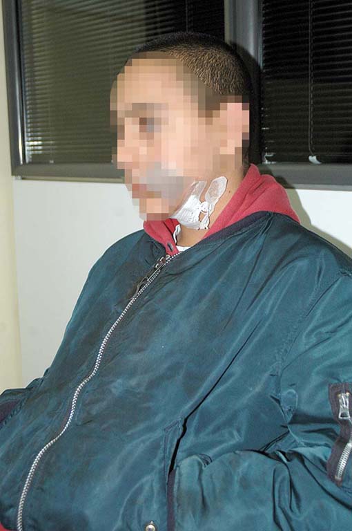 Ataque a un menor en pleno desarrollo de las murgas