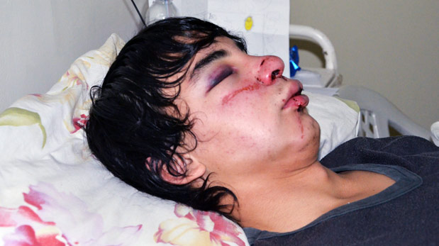 Menor resultó desfigurado al ser agredido en pleno centro