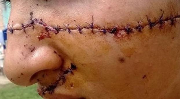 Horror en Formosa: La desfiguran por «linda»