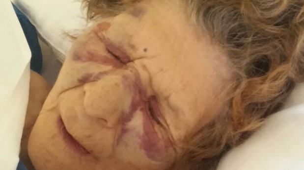 Brutal ataque a una anciana en km. 3