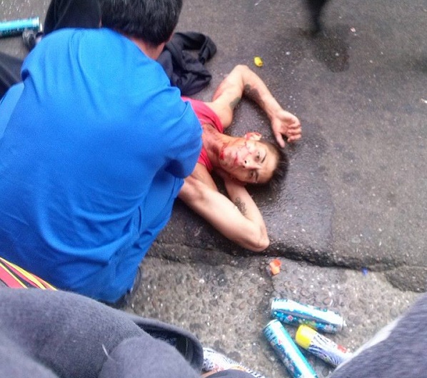 Un joven fue apuñalado en los carnavales