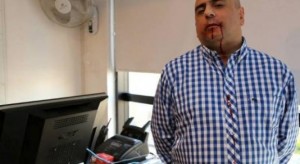 periodista golpeado por de narváez