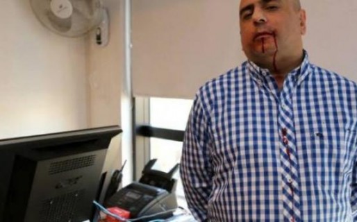 De Narváez noqueó a un periodista por una publicación