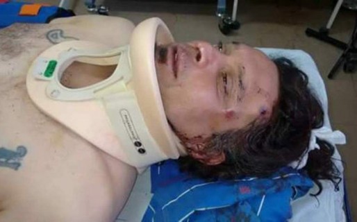 Truncado: Brutal agresión a un petrolero en los piquetes