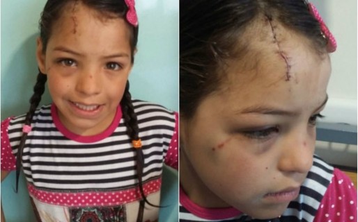 Milagros: «Si le dan amor y cariño al perro que me atacó capaz cambia»