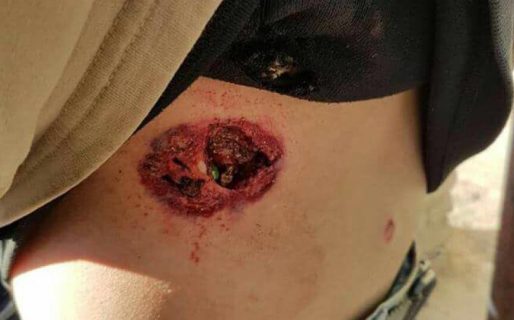 Paro y represión en Neuquén: «No hubo un muerto de casualidad»