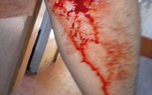 Varios policías lesionados, dos móviles rotos y un detenido en las 1008