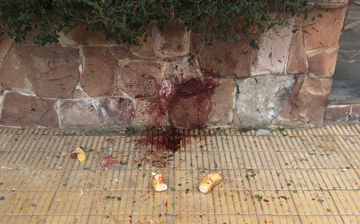 La condición del hombre atacado en el centro sería grave e irreversible