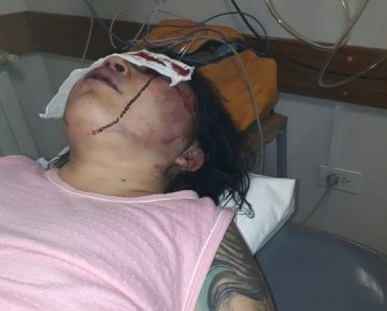 La mujer brutalmente golpeada por su ex pareja: «necesito custodia y que pidan la prisión preventiva»