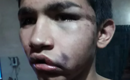 La UR evalúa denunciar a una madre que los acusó de abuso de autoridad