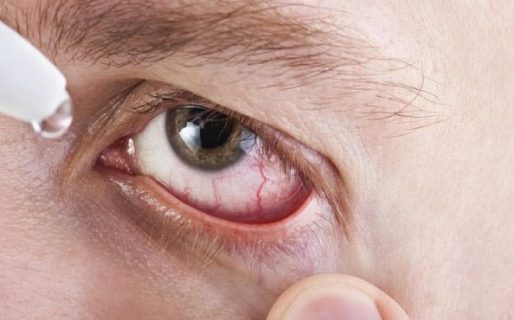 Dolencias 2.0: cuello de whatsapp, pulgar atascado y ojo seco