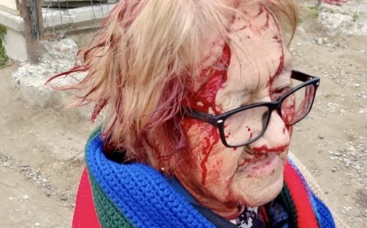 Una abuela de 88 años fue atacada por cuatro perros