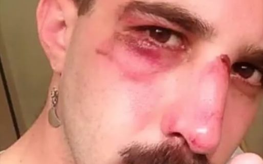 Brutal ataque homofóbico a un periodista oriundo de Chubut