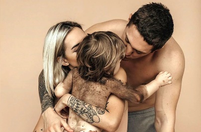 Una influencer rusa visibilizó la extraña enfermedad que padece su hijo