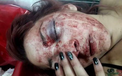 Otra agresión afuera de un boliche: la golpearon salvajemente hasta dejarla inconsciente