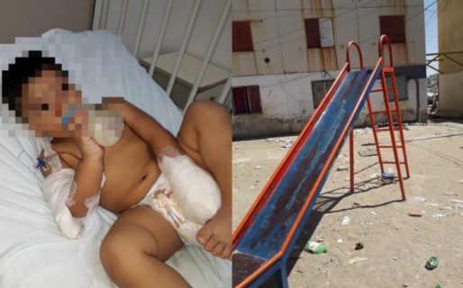 Un nene de dos años perdió un dedo en un tobogán