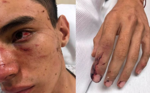 Un rugbier sufrió una brutal paliza y sugirió que hubo ensañamiento