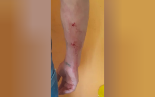 Un joven fue atacado con un cuchillo por su ex suegra