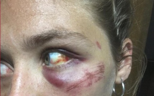 “Vos me pones así”: el infierno de una joven de 21 años golpeada por su exnovio