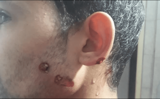 Salió a comprar pan y le dispararon en la cara