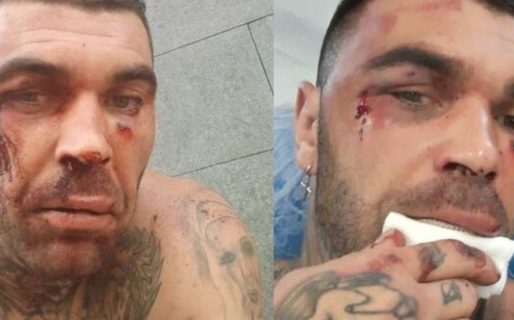 El barrabrava nazi más temido de España recibió una feroz paliza