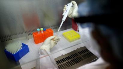 Ya son 83 los fallecidos por coronavirus en el país