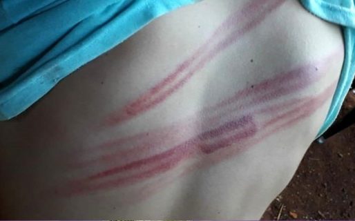 Lo azotaron entre siete policías cuando volvía de la carnicería