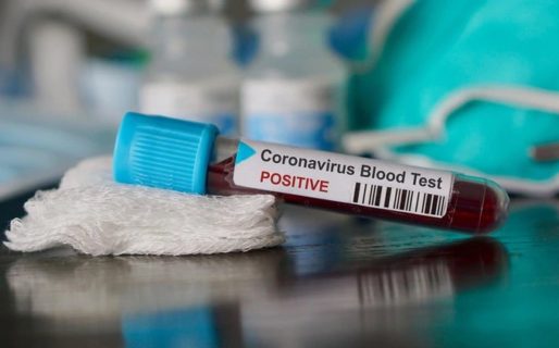 Un comodorense dio positivo de Coronavirus en Buenos Aires