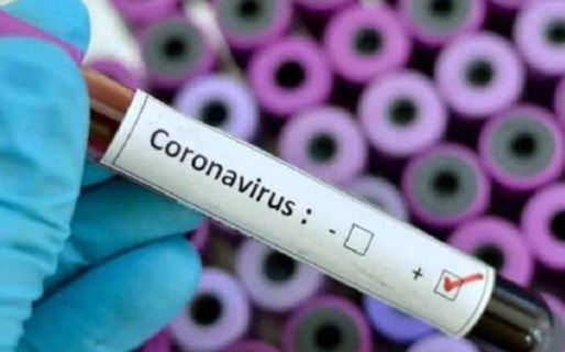 Se confirmaron 8 muertes y 149 nuevos casos de COVID-19 en las últimas 24 horas