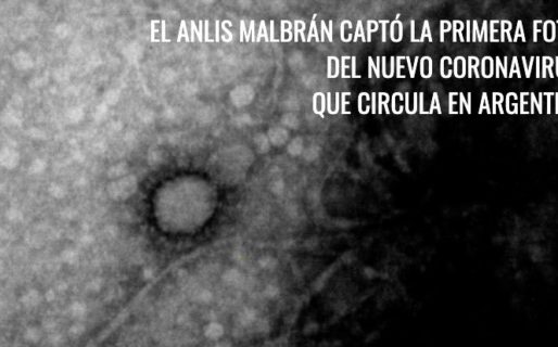 El Malbrán consiguió la primera foto del COVID-19 que circula en la Argentina