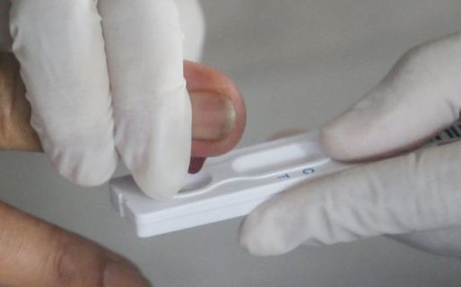 Cómo son las pruebas serológicas y moleculares para detectar el covid-19