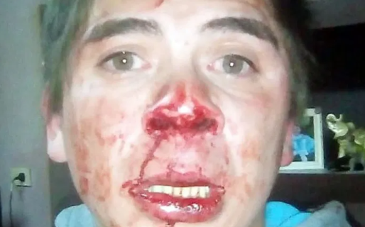 Por una golpiza policial: joven tiene problemas en los genitales