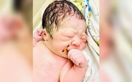 Un bebé nació con el DIU en la mano