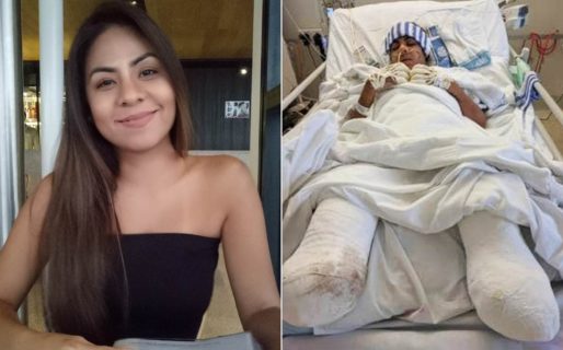 El desgarrador caso de la mujer con los dedos negros: su tragedia y su mensaje inspirador