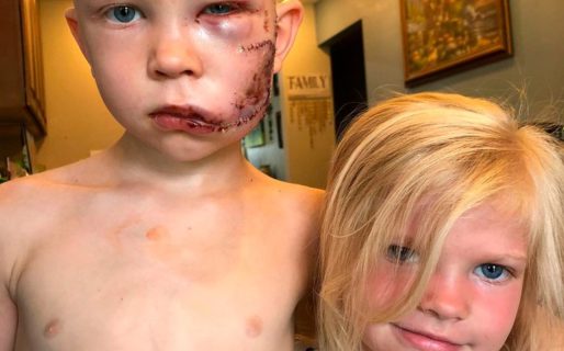 El niño héroe que salvó a su hermana del ataque de un perro: “Si alguien debía morir, tenía que ser yo”