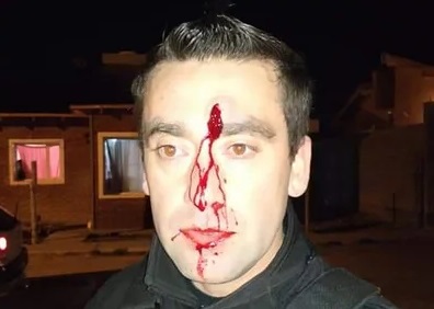 Peleaban entre ellos y al arribar la policía, se unieron para atacarlos con palos y botellas