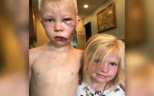 Le entregaron el cinturón de “El hombre más valiente de la Tierra” al niño que salvó a su hermana del ataque de un perro