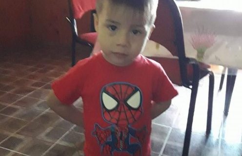 Un nene fue atacado por un pitbull necesita una reconstrucción facial, realizaron una colecta de dinero