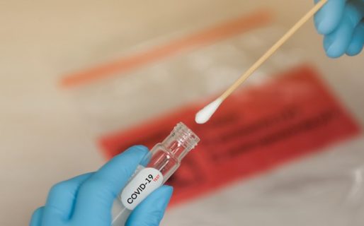 Se registraron 160 muertes y 7491 nuevos contagios en las últimas 24 horas