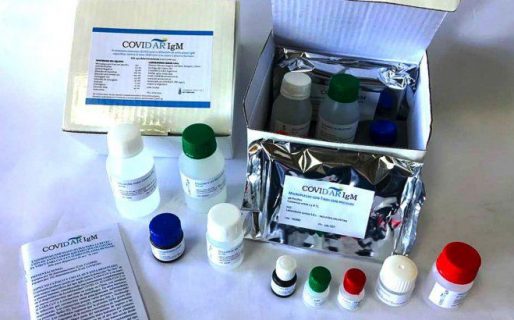 Ginés presentó test rápido para detectar coronavirus en 20 minutos