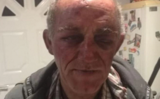 Dramático asalto a un hombre: “Me querían abrir la boca para sacarme los dientes con la pinza”