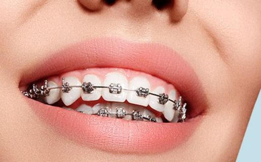 Lastimó a su novio en el pene con los brackets, pidió ayuda al SAME y se burlaron