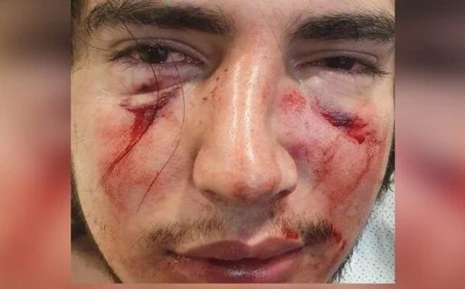 Denuncian una feroz golpiza de rugbiers en Córdoba