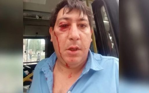 Le rompieron la cabeza a piedrazos por no dejar subir al colectivo que iba lleno