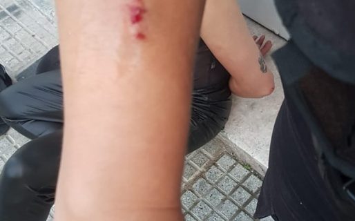 Accidente múltiple y ataque “caníbal” en Floresta: una mujer chocó, volcó y mordió a dos policías