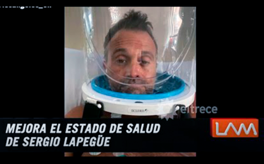 Qué es un Helmet, el “casco” que ayuda a Sergio Lapegüe a respirar mejor
