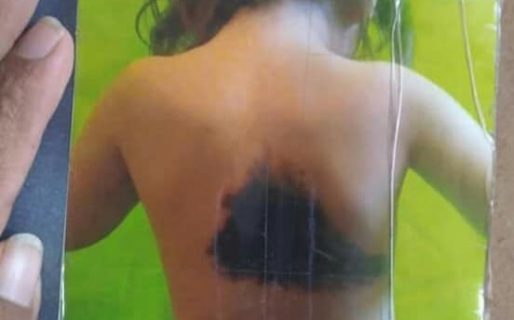 Santino necesita viajar a Buenos Aires para un control antes de su cirugía