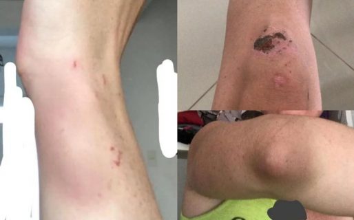 Denunciaron a un instructor de MMA por amenazar y golpear a su ex pareja