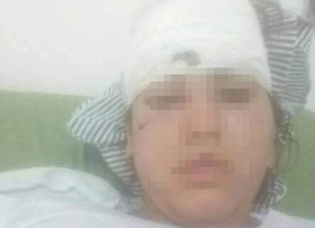 Dieron de alta a la joven que fue brutalmente golpeada en el Abásolo