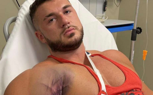 Un fisicoculturista se arrancó el músculo pectoral por levantar mucho peso